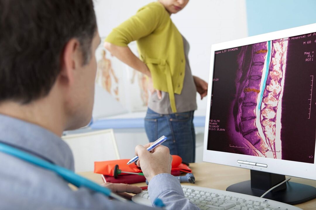 Diagnose einer lumbalen Osteochondose