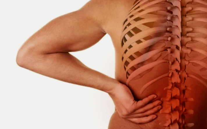 Die Ursachen der Osteochondose der Lendenwirbelsäule