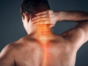 Die ersten Anzeichen und Symptome einer zervikalen Osteochondose
