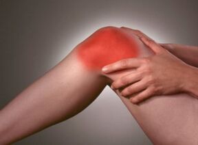 Das Symptom einer Arthrose sind starke Schmerzen im Kniebereich